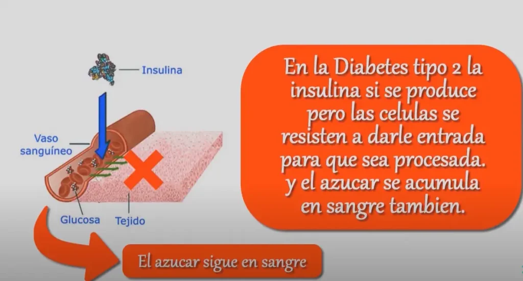 ¿Cuál es la principal diferencia entre la diabetes tipo 1 y tipo 2?