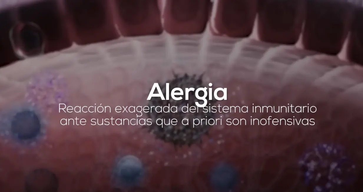 Alergias y sistema inmunológico
